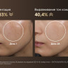 Маска для омоложения лица Dreame Chrona Pro Photon Anti-Aging Skincare Mask AB01P