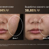 Маска для омоложения лица Dreame Chrona Pro Photon Anti-Aging Skincare Mask AB01P