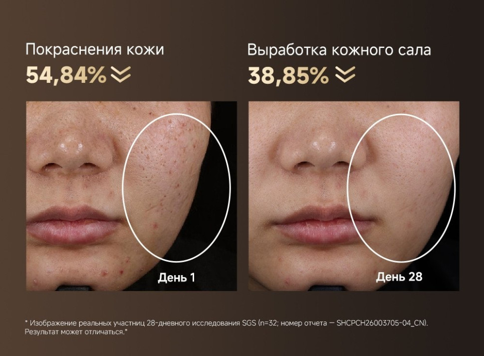Маска для омоложения лица Dreame Chrona Pro Photon Anti-Aging Skincare Mask AB01P