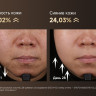 Маска для омоложения лица Dreame Chrona Pro Photon Anti-Aging Skincare Mask AB01P