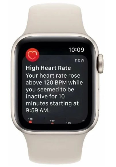 Умные часы Apple Watch SE 2 2023 40мм (сияющая звезда/сияющая звезда, S/M)